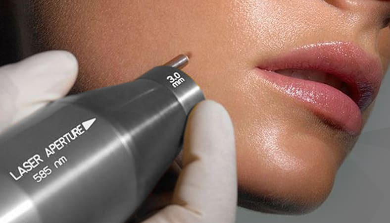 Голливудское омоложение Affirm в Екатеринбурге